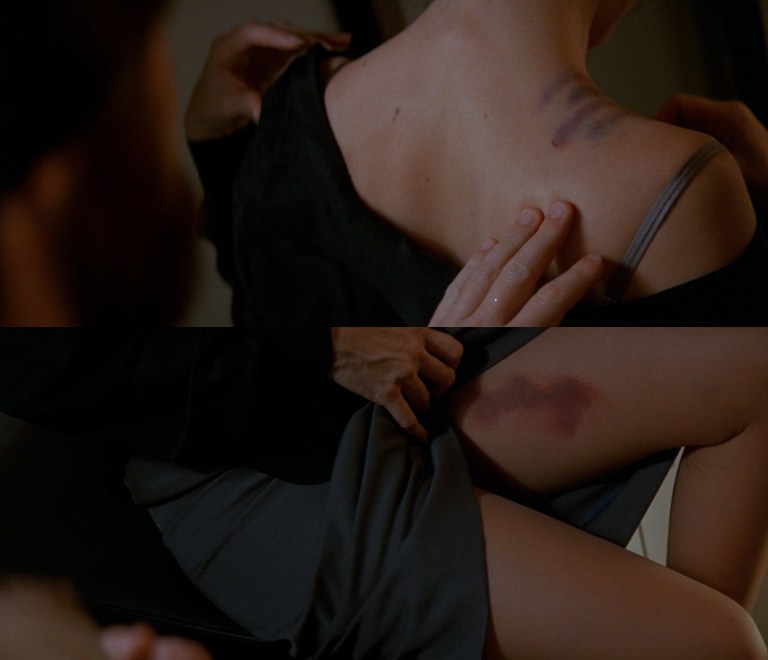 Carla's bruises in The Entity (1982).