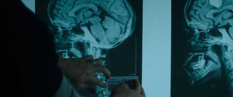 Logan Nelson mislabels John Kramer's x-ray in Jigsaw (2017).