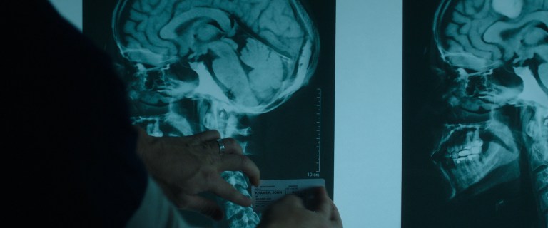 Logan Nelson mislabels John Kramer's x-ray in Jigsaw (2017).