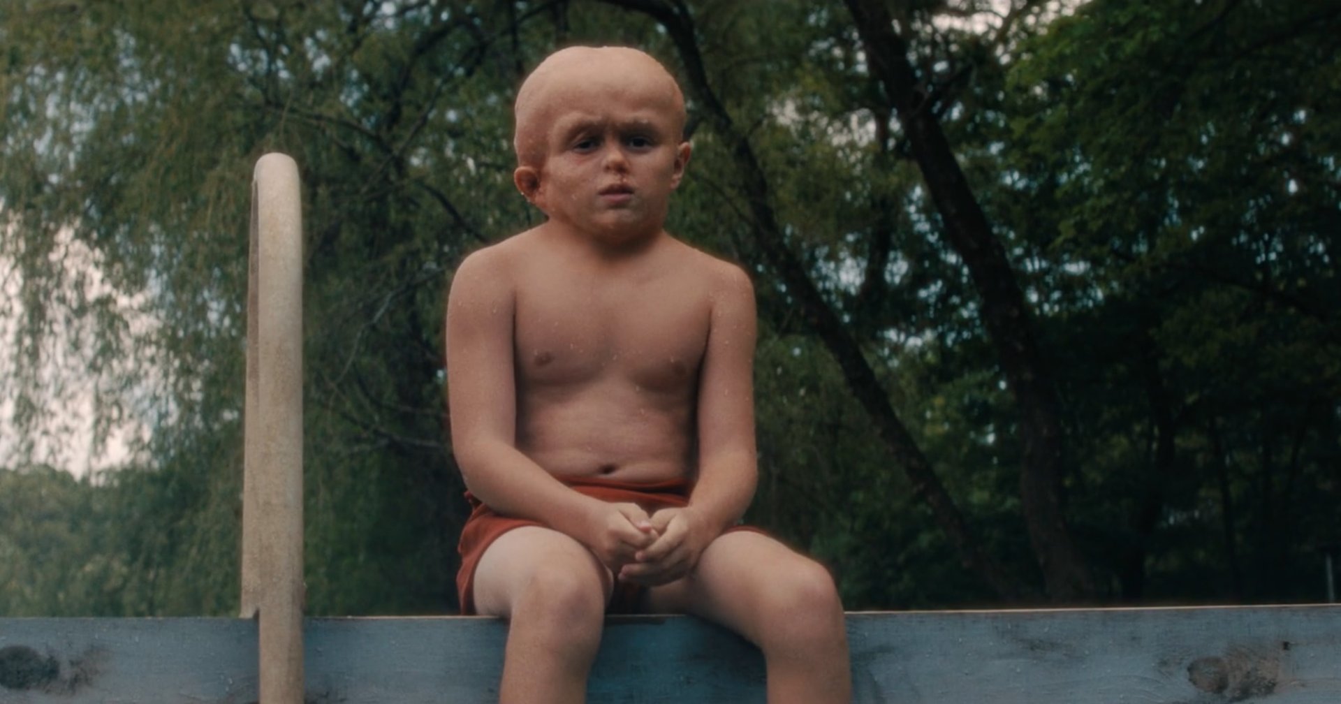 Shirtless bald young boy sitting on a wooden ledge outdoors with trees in the background, looking solemn.